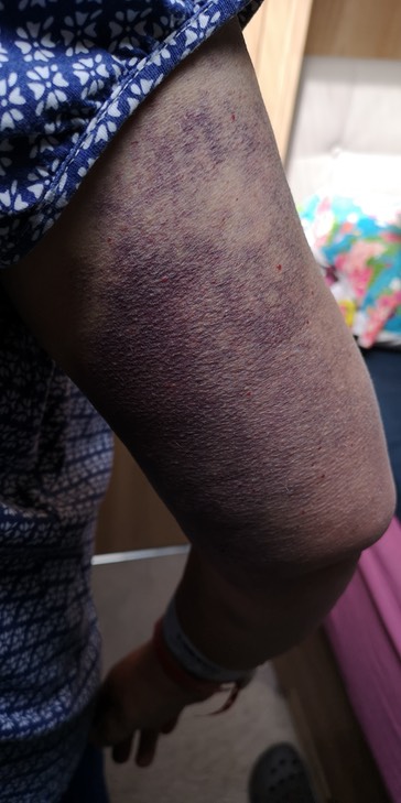 IMG_20200723_104641_1